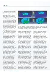 Thế giới Nhựa :Số tháng 08 - 2016